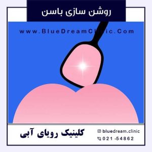 بهترین راه سفید کردن باسن