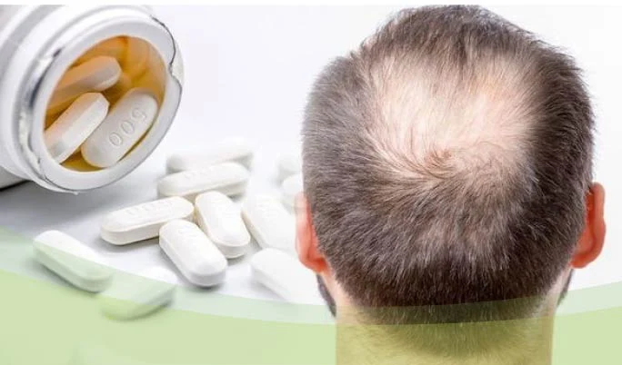 بهترین قرص برای رشد مجدد موهای ریخته شده