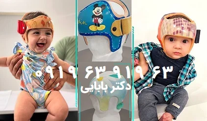 دلایل و راه‌های درمان کج شدن سر نوزاد